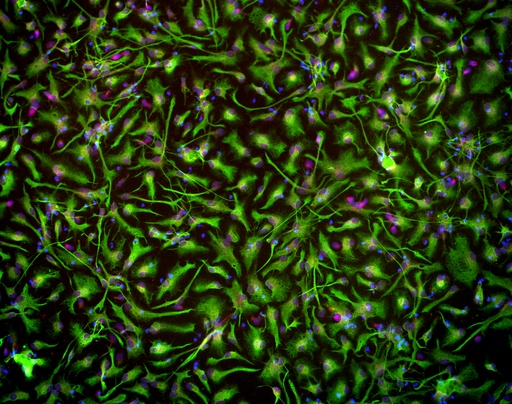[25sk130] Cortical Astrocytes