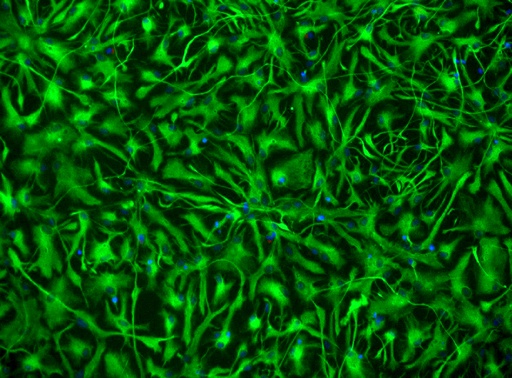 [25sk131] Spinal Astrocytes
